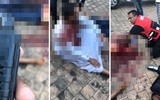 [Ảnh] Tấn công Nhà thờ Hồi giáo bằng dao gây thương vong ở Nam Phi