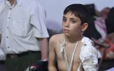 Những hình ảnh ít người biết bên trong bệnh viện ngầm ở Douma, Syria