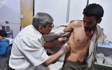 Những hình ảnh ít người biết bên trong bệnh viện ngầm ở Douma, Syria
