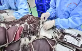 [ẢNH] Bác sỹ căng mình làm việc 12 tiếng 1 ngày trong bối cảnh thiếu máu do ảnh hưởng của dịch Corona