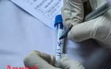 [ẢNH] Người dân mang cả hành lý, sẵn sàng cách ly khi đi test nhanh Covid-19 ở Hà Nội