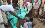 Xót xa khi chứng kiến hình ảnh trẻ đói ăn suy dinh dưỡng ở Yemen