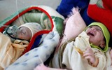 Xót xa khi chứng kiến hình ảnh trẻ đói ăn suy dinh dưỡng ở Yemen