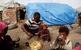 Xót xa khi chứng kiến hình ảnh trẻ đói ăn suy dinh dưỡng ở Yemen