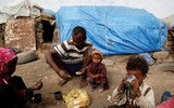 Xót xa khi chứng kiến hình ảnh trẻ đói ăn suy dinh dưỡng ở Yemen