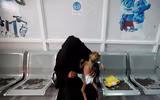 Xót xa khi chứng kiến hình ảnh trẻ đói ăn suy dinh dưỡng ở Yemen
