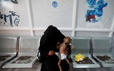 Xót xa khi chứng kiến hình ảnh trẻ đói ăn suy dinh dưỡng ở Yemen