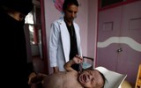 Xót xa khi chứng kiến hình ảnh trẻ đói ăn suy dinh dưỡng ở Yemen