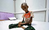 Xót xa khi chứng kiến hình ảnh trẻ đói ăn suy dinh dưỡng ở Yemen