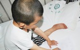 Bị mẹ bỏ rơi vì bạo bệnh, bé trai 4 tuổi vẽ mẹ ngắm cho vơi nỗi nhớ