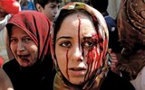 Hình ảnh biết nói về cuộc chiến đẫm máu tại Syria (1)