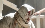 Hình ảnh biết nói về cuộc chiến đẫm máu tại Syria (1)