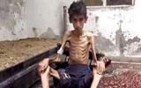 Hình ảnh biết nói về cuộc chiến đẫm máu tại Syria (1)