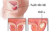 [ẢNH] Syria vừa thu vũ khí hạng nặng nào của Mỹ trong tay phiến quân?