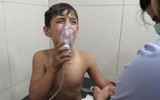 [ẢNH] Phiến quân tấn công hóa học, Nga tức tốc điều chuyên gia sang Syria