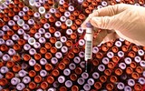 [ẢNH] Chấn động khi phát hiện 12.000 chai huyết tương nhiễm HIV