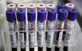 [ẢNH] Chấn động khi phát hiện 12.000 chai huyết tương nhiễm HIV