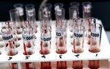 [ẢNH] Chấn động khi phát hiện 12.000 chai huyết tương nhiễm HIV