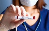[ẢNH] Anh nghi ngờ chất lượng hàng triệu bộ kit xét nghiệm Covid-19 từ Trung Quốc