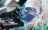 [ẢNH] Vaccine chống dịch Covid-19 có thể tới tay bác sĩ chữa bệnh vào tháng 9