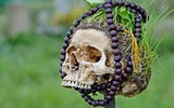 [ẢNH] 20 căn bệnh hiếm gặp nhất thế giới