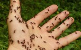 [ẢNH] 20 căn bệnh hiếm gặp nhất thế giới
