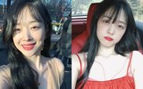 [ẢNH] Ngoài Sulli, bệnh trầm cảm từng 