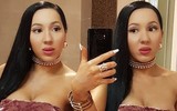 Cặp chị em song sinh chung bạn trai 8 năm tiếc nuối nhan sắc quá khứ vì thẩm mỹ quá đà