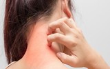 Những lợi ích tuyệt vời của trà không phải ai cũng biết