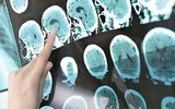 Những lợi ích tuyệt vời của trà không phải ai cũng biết