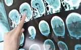 Những lợi ích tuyệt vời của trà không phải ai cũng biết