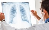 Nhận biết sớm những dấu hiệu viêm phổi để cả nhà 