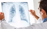 Nhận biết sớm những dấu hiệu viêm phổi để cả nhà 