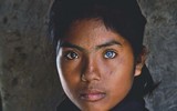 [ẢNH] Bí ẩn những đôi mắt dị thường hiếm gặp nhất trên thế giới