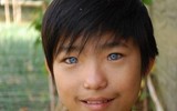[ẢNH] Bí ẩn những đôi mắt dị thường hiếm gặp nhất trên thế giới