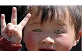 [ẢNH] Bí ẩn những đôi mắt dị thường hiếm gặp nhất trên thế giới