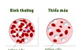 [ẢNH] Khiếp sợ bệnh nặng dễ mắc do Tết uống rượu 
