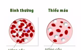 [ẢNH] Khiếp sợ bệnh nặng dễ mắc do Tết uống rượu 