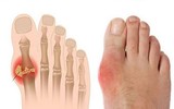 [ẢNH] Khiếp sợ bệnh nặng dễ mắc do Tết uống rượu 