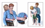 Những tai nạn rình rập trẻ em dịp Tết
