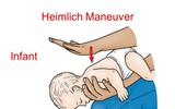Những tai nạn rình rập trẻ em dịp Tết