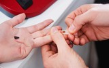 Quy trình xử lý chống phơi nhiễm HIV