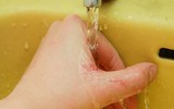 Quy trình xử lý chống phơi nhiễm HIV