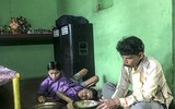 [ẢNH] Cặp song sinh từ chối phẫu thuật tách rời, chấp nhận khó khăn gắn bó cả đời