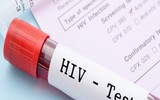 Quy trình xử lý chống phơi nhiễm HIV