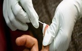 Quy trình xử lý chống phơi nhiễm HIV