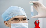 Quy trình xử lý chống phơi nhiễm HIV