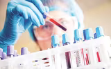 Quy trình xử lý chống phơi nhiễm HIV