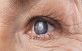 7 tác hại đáng sợ của tia UV đối với cơ thể