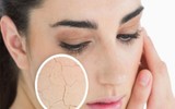 7 tác hại đáng sợ của tia UV đối với cơ thể